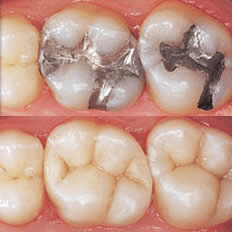 Cosmetic Dentistry